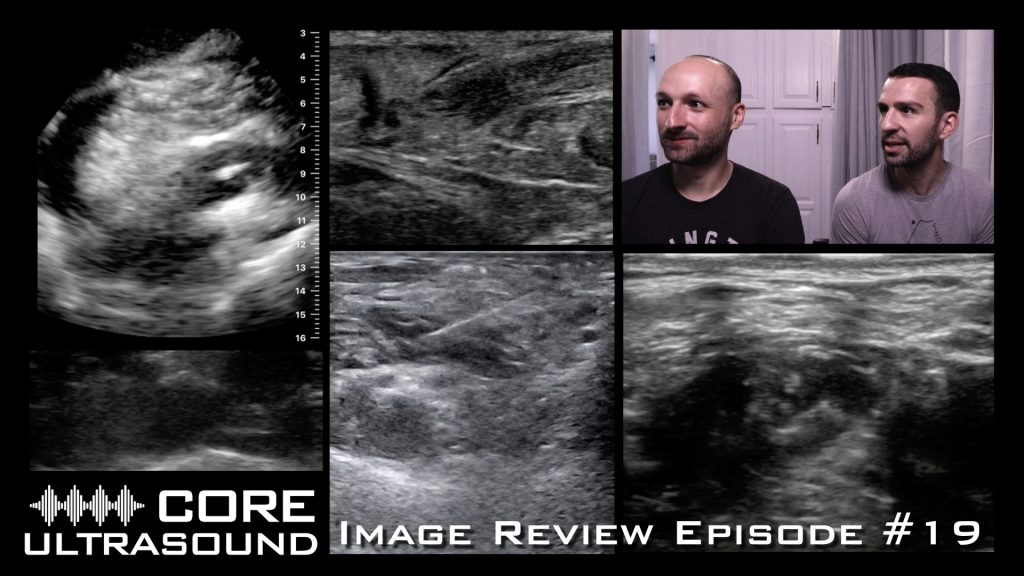 Core Ultrasound Image Review Episode Core Ultrasound