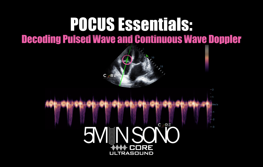 PW and CW Doppler Physics 5MS Core Ultrasound
