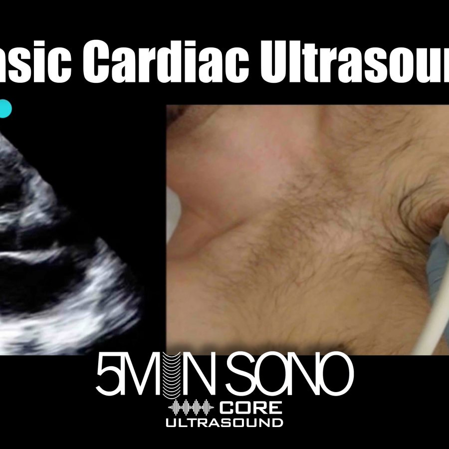Volume Responsiveness LVOT VTI Core Ultrasound Volume Responsiveness LVOT VTI Core Ultrasound