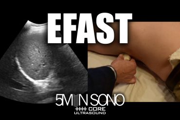 EFAST - 5minsono