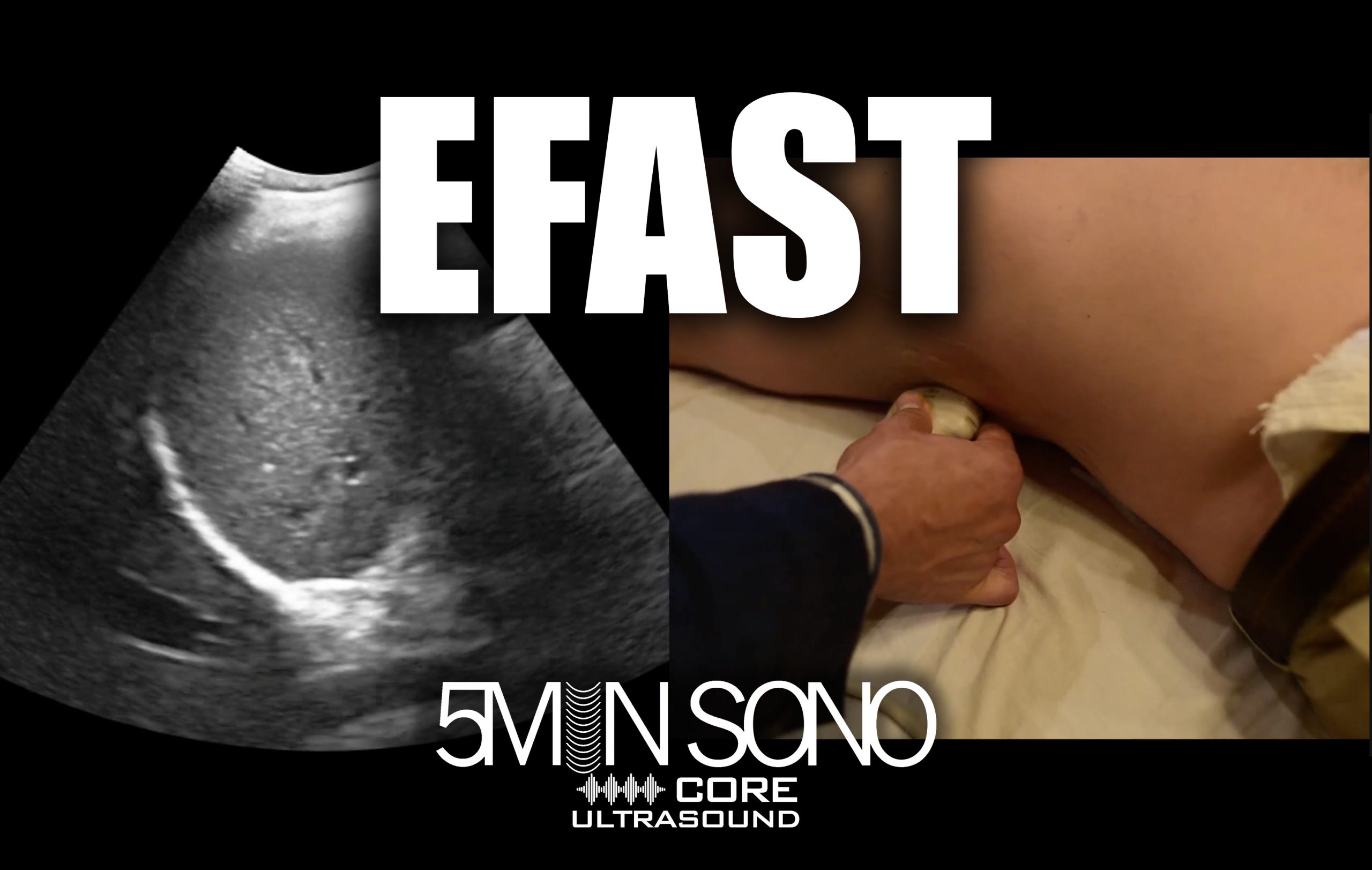 EFAST - Core Ultrasound