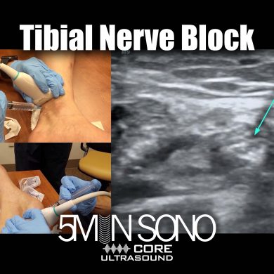 5 Minute Sono – Core Ultrasound