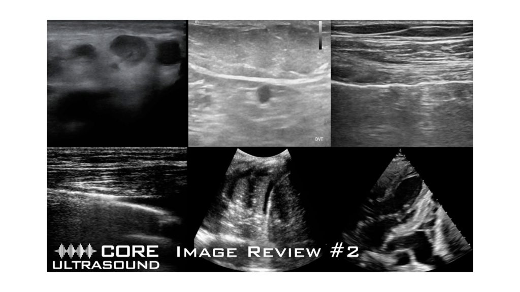 Core Ultrasound Image Review #2 – Core Ultrasound