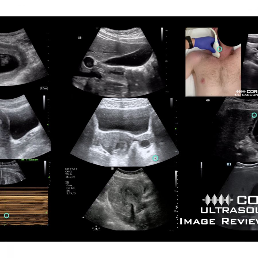 Core Ultrasound Image Review #2 – Core Ultrasound