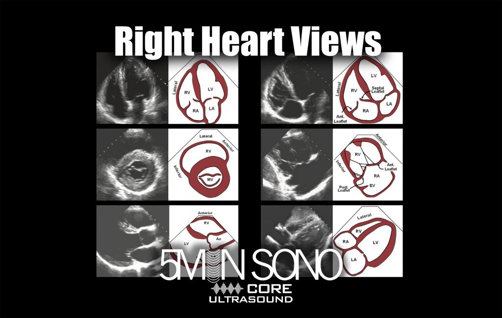 Right Heart Views – Core Ultrasound