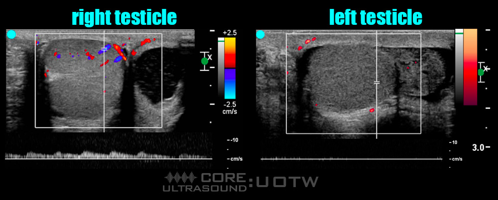 EP 21  ultrasound