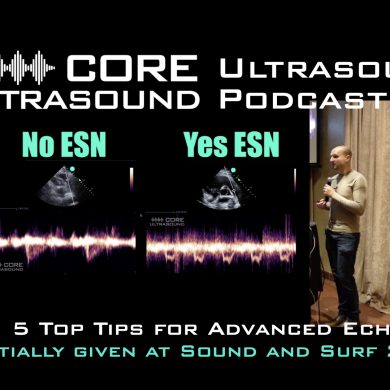 Five Top tips for advanced echo