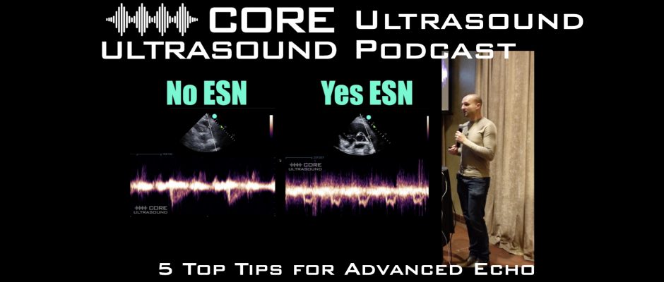 Five Top tips for advanced echo