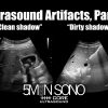 Ultrasound artifacts, part one
