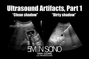 Ultrasound artifacts, part one