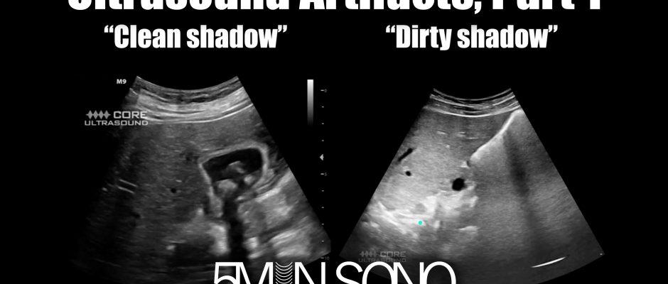 Ultrasound artifacts, part one