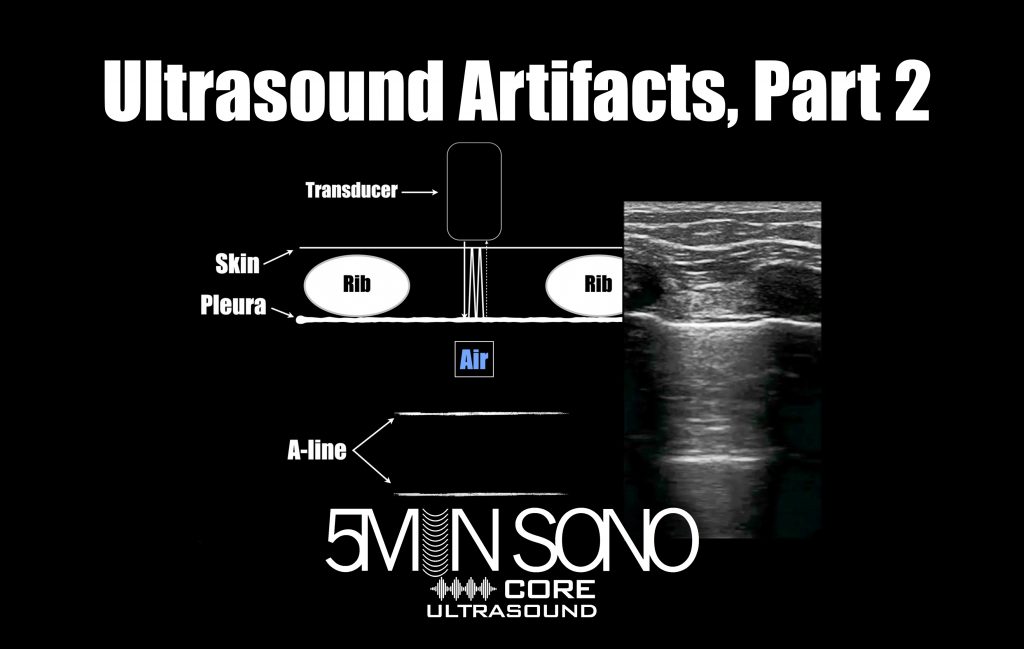 Ultrasound Artifacts Part 2 Core Ultrasound