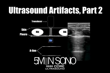 Ultrasound artifacts, part two