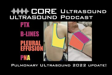 Pulmonary ultrasound 2022 update. Part one: PTX, BLines, Effusion, Pna.