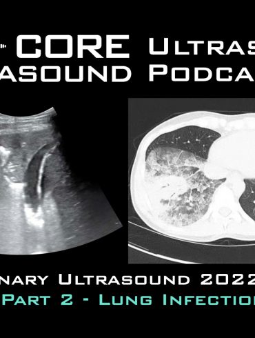 Pulmonary ultrasound 2022 update. Part two: lung infections.