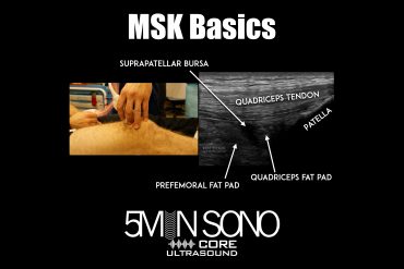 MSK Basics - 5minsono