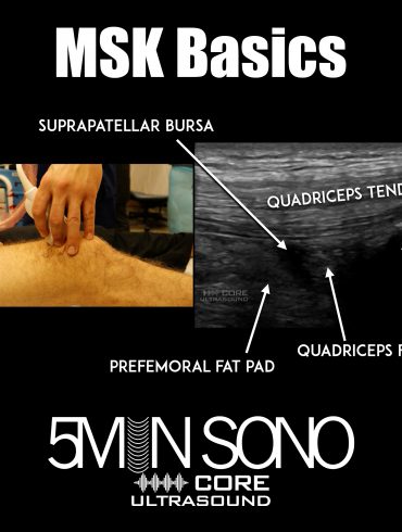 MSK Basics - 5minsono