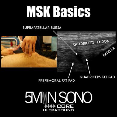 MSK Basics - 5minsono
