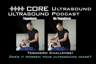Tegaderm Challenge! Does it worsen your ultrasound image?