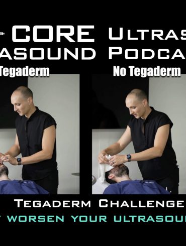 Tegaderm Challenge! Does it worsen your ultrasound image?