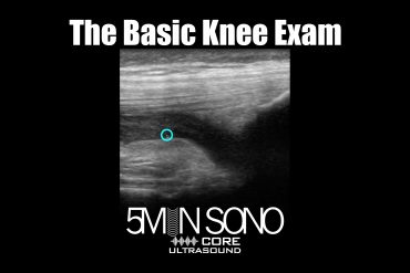 The Basic Knee Exam