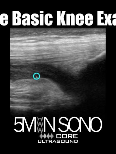 The Basic Knee Exam