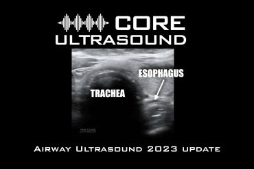 Airway Ultrasound 2023 Update