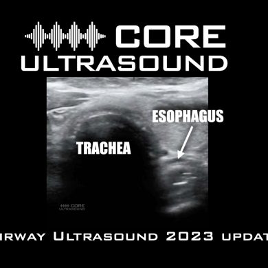 Airway Ultrasound 2023 Update