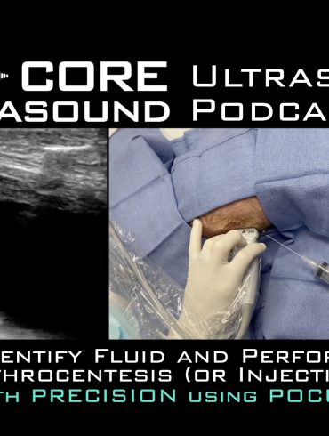Identify fluid and perform arthrocentesis or injection with precision using pocus.