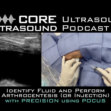 Identify fluid and perform arthrocentesis or injection with precision using pocus.