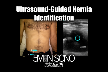 Ultrasound Guided Hernia Identification