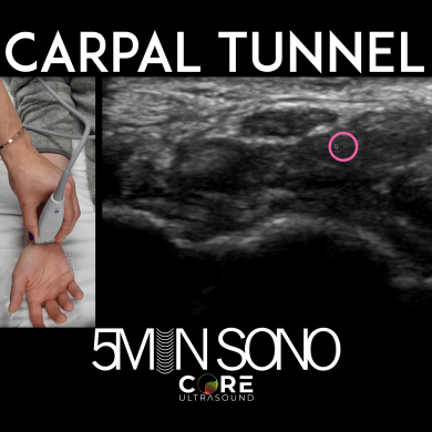 Carpal Tunnel Exam - Core Ultrasound