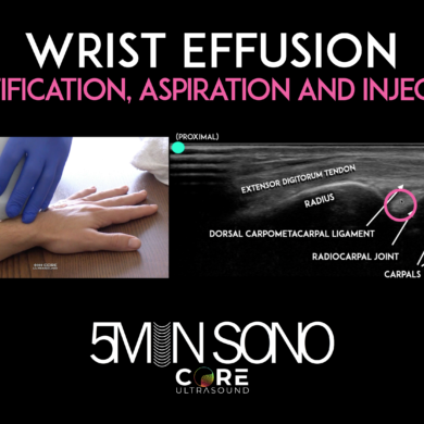 Wrist Ultrasound - Aspiration and injection - Core Ultrasound