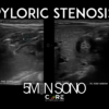 Pyloric Stenosis Core Ultrasound