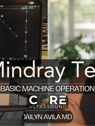 Mindray TeX Ultrasound Machine Core Ultrasound